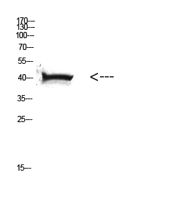 HLA Class I Polyclonal Antibody