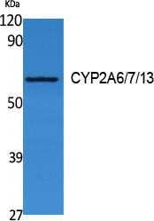 CYP2A6/7/13 Polyclonal Antibody