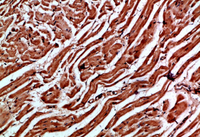 Cytoglobin Polyclonal Antibody