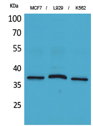 CD79b Polyclonal Antibody