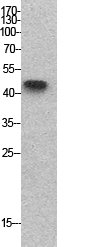 p53 Polyclonal Antibody