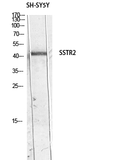 SSTR2 Polyclonal Antibody