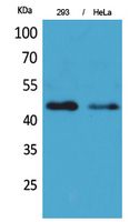 IDH1 Polyclonal Antibody