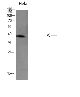 TIM-1 Polyclonal Antibody