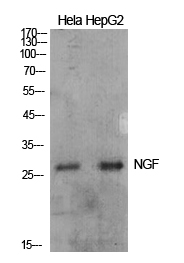 NGF Polyclonal Antibody