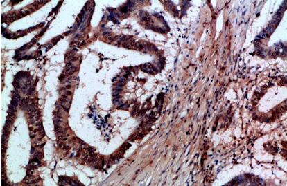 FAS-L Polyclonal Antibody