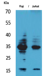 IL-4 Polyclonal Antibody