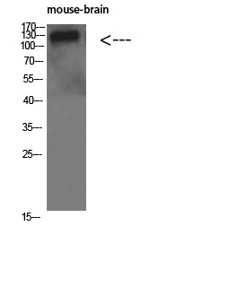 Collagen IV Polyclonal Antibody