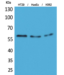 CYP11B1/2 Polyclonal Antibody