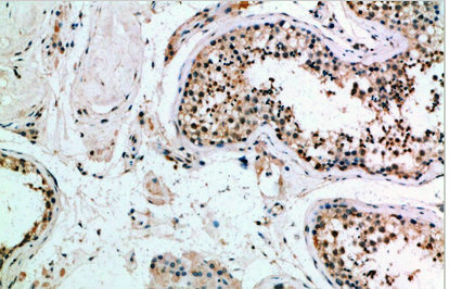 Frizzled-9 Polyclonal Antibody