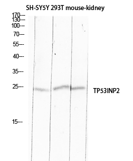 TP53INP2 Polyclonal Antibody