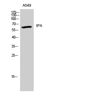 tPA Polyclonal Antibody