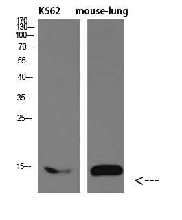 I-FABP Polyclonal Antibody