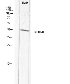 Nodal Polyclonal Antibody