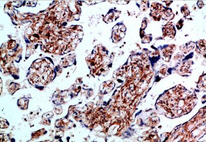 BMPR-IB Polyclonal Antibody