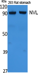 NVL Polyclonal Antibody