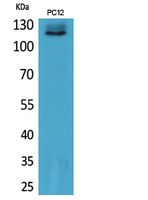 UBA1 Polyclonal Antibody