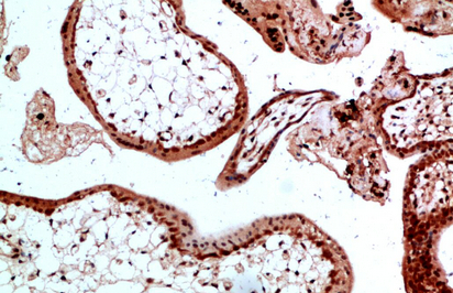 Ub Polyclonal Antibody