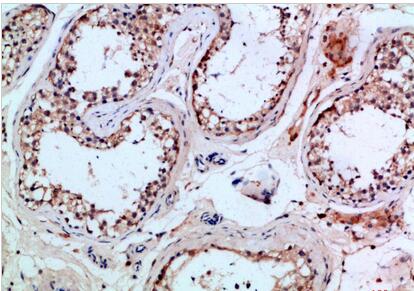 PI 3-Kinase p85β Polyclonal Antibody