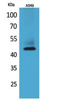 Cytokeratin 19 Polyclonal Antibody