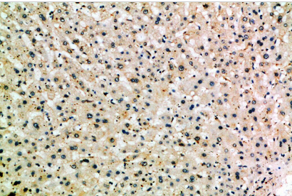 CD204 Polyclonal Antibody