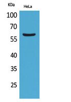 FMO3 Polyclonal Antibody