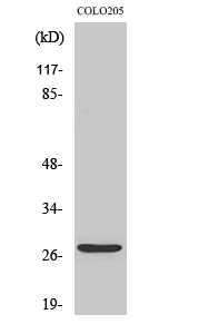 TP53INP1 Polyclonal Antibody