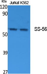 SS-56 Polyclonal Antibody