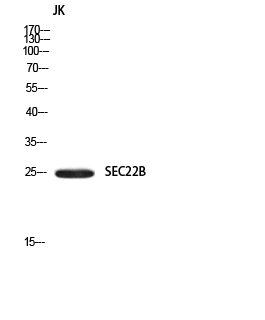 SEC22B Polyclonal Antibody