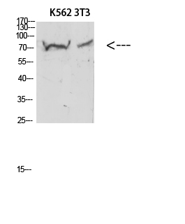 Endoglin Polyclonal Antibody