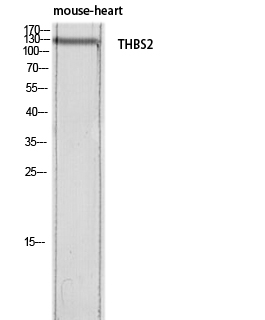 Thrombospondin 2 Polyclonal Antibody