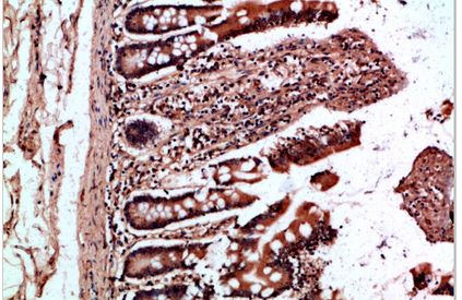 OSM Polyclonal Antibody