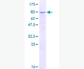 Recombinant Human Fibroblast Growth Factor 8/FGF-8F