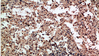 PF-4 Polyclonal Antibody