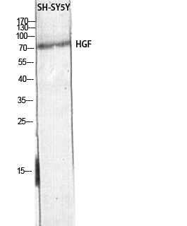 HGF Polyclonal Antibody