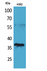 CD207 Polyclonal Antibody