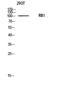 Rb Polyclonal Antibody