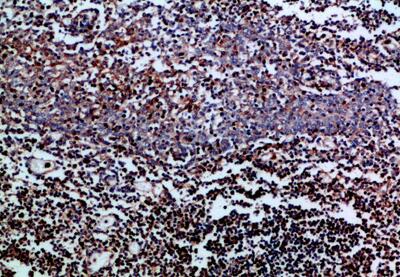 CD3 ζ Polyclonal Antibody