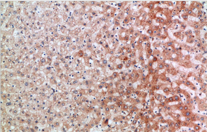 ST2 Polyclonal Antibody