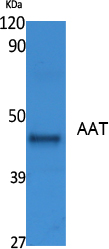 AAT Polyclonal Antibody