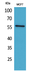 ALK-1 Polyclonal Antibody