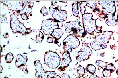 GH Polyclonal Antibody