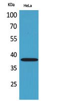 CD158b2/j Polyclonal Antibody