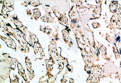 IFN-β Polyclonal Antibody