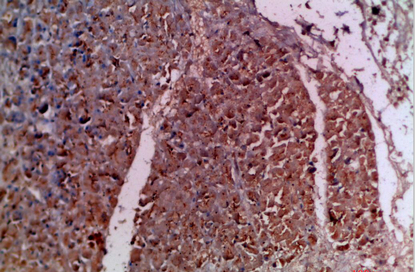 IL-20 Polyclonal Antibody