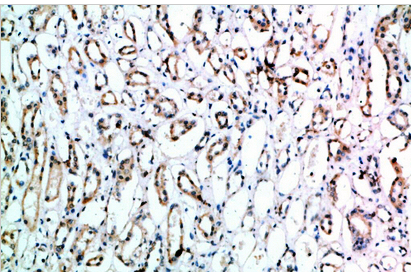 CD151 Polyclonal Antibody