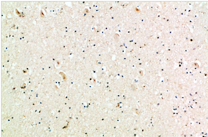 MIG Polyclonal Antibody