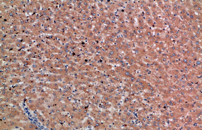 Chordin Polyclonal Antibody