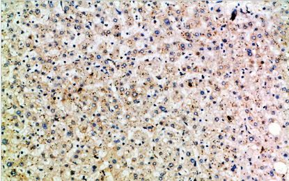 HSP 75 Polyclonal Antibody