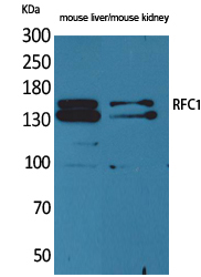 RFC1 Polyclonal Antibody